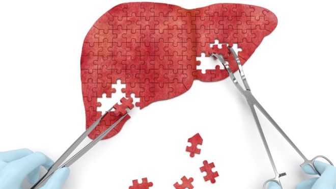 Novos surtos em São Paulo e no Rio revertem uma década de queda nos casos de hepatite A